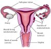 endometriosis-anatomy-final_default.jpg