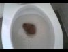 shit in a toilet.jpg