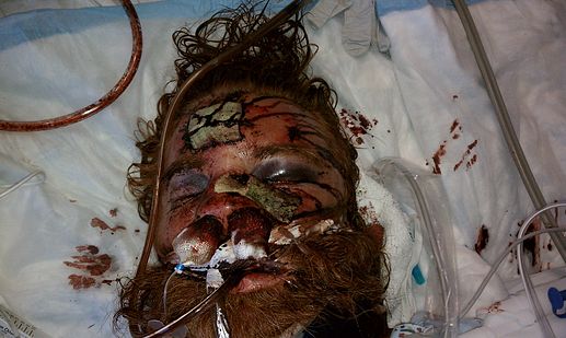 Kelly-Thomas-Police-Beating4.jpg