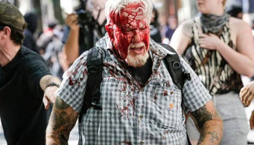 bloody.jpg