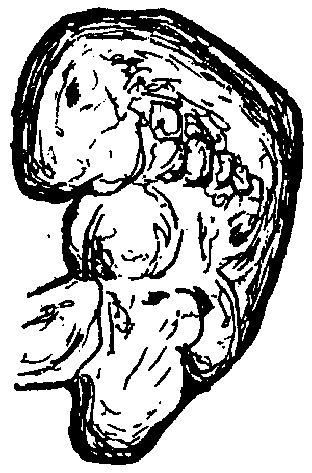 Image16.gif
