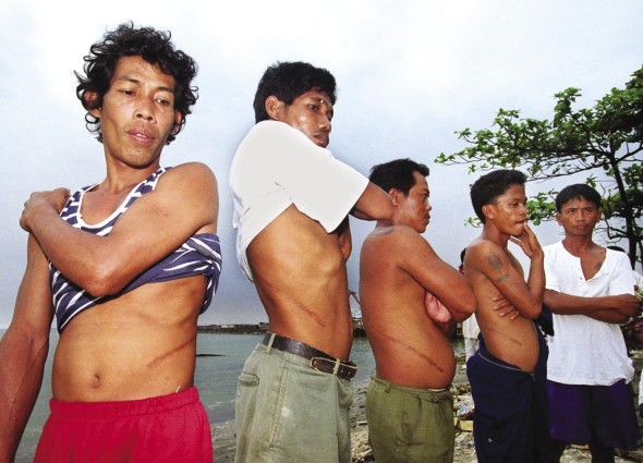 men-with-scars-590.jpg