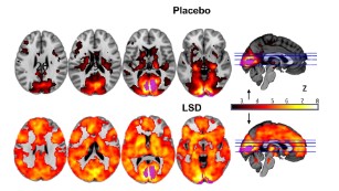 This is your brain on LSD, literally